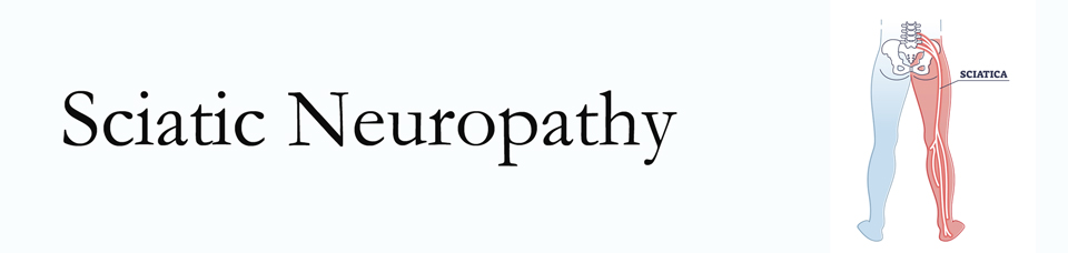 Toronto neuropathy pain (sciatica) 